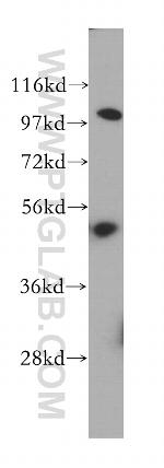 OAS1 Antibody in Western Blot (WB)