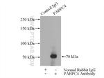 PABPC4 Antibody in Immunoprecipitation (IP)