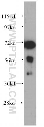 PABPC4 Antibody in Western Blot (WB)
