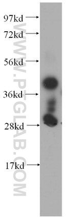 SERPINB6 Antibody in Western Blot (WB)