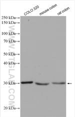 DDAH2 Antibody in Western Blot (WB)
