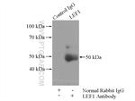 LEF1 Antibody in Immunoprecipitation (IP)