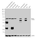 Desmin Antibody in Western Blot (WB)