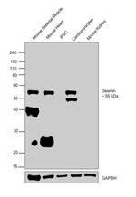 Desmin Antibody in Western Blot (WB)