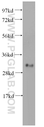 METTL1 Antibody in Western Blot (WB)