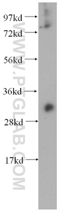 METTL1 Antibody in Western Blot (WB)