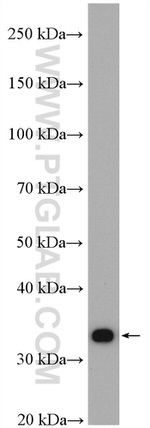 METTL1 Antibody in Western Blot (WB)