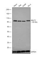 MALT1 Antibody in Western Blot (WB)