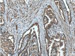 HAI-1 Antibody in Immunohistochemistry (Paraffin) (IHC (P))