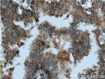 HAI-1 Antibody in Immunohistochemistry (Paraffin) (IHC (P))