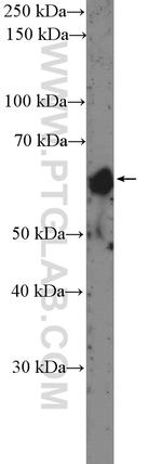 HAI-1 Antibody in Western Blot (WB)