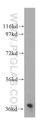 NAGK Antibody in Western Blot (WB)