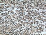 SMOX Antibody in Immunohistochemistry (Paraffin) (IHC (P))