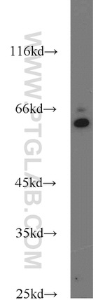 SMOX Antibody in Western Blot (WB)