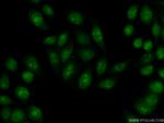 EXOSC3 Antibody in Immunocytochemistry (ICC/IF)