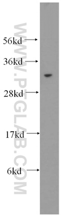 EXOSC3 Antibody in Western Blot (WB)