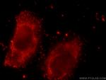 NDUFS3 Antibody in Immunocytochemistry (ICC/IF)