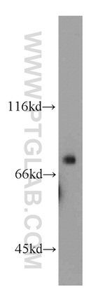 HPS1 Antibody in Western Blot (WB)