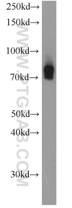 HPS1 Antibody in Western Blot (WB)