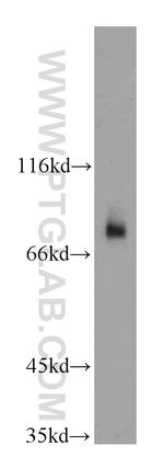 HPS1 Antibody in Western Blot (WB)