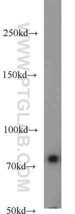 HPS1 Antibody in Western Blot (WB)