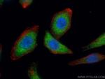 VPS8 Antibody in Immunocytochemistry (ICC/IF)