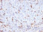 Cathepsin K Antibody in Immunohistochemistry (Paraffin) (IHC (P))