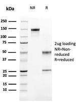 Cathepsin K Antibody in SDS-PAGE (SDS-PAGE)