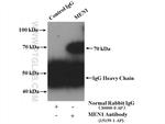 MEN1 Antibody in Immunoprecipitation (IP)