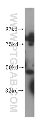 WDR18 Antibody in Western Blot (WB)