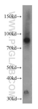 CPT1A Antibody in Western Blot (WB)