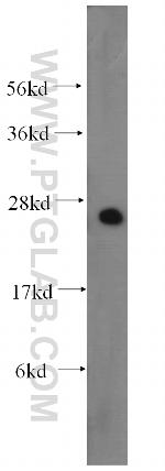 DCXR Antibody in Western Blot (WB)