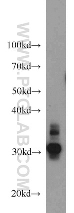 RPS3 Antibody in Western Blot (WB)