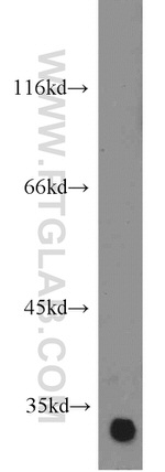 RPS3 Antibody in Western Blot (WB)