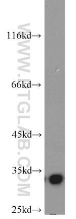 RPS3 Antibody in Western Blot (WB)