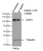 KAP1 Antibody in Western Blot (WB)