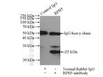 RPB5 Antibody in Immunoprecipitation (IP)