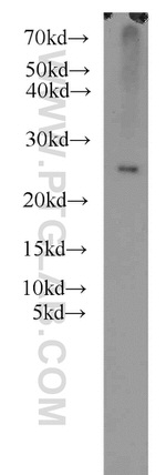 RPB5 Antibody in Western Blot (WB)