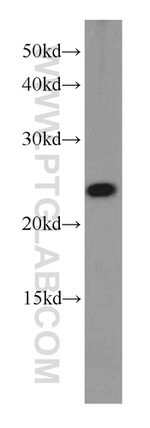 RPB5 Antibody in Western Blot (WB)