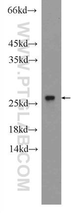 RPB5 Antibody in Western Blot (WB)