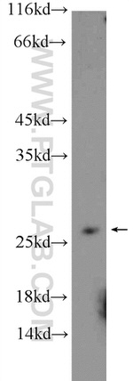 RPB5 Antibody in Western Blot (WB)