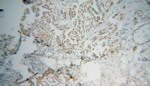 RPAIN Antibody in Immunohistochemistry (Paraffin) (IHC (P))