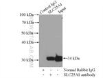 SLC25A1 Antibody in Immunoprecipitation (IP)