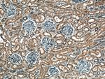 S6K2 Antibody in Immunohistochemistry (Paraffin) (IHC (P))