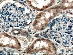 S6K2 Antibody in Immunohistochemistry (Paraffin) (IHC (P))