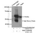 S6K2 Antibody in Immunoprecipitation (IP)