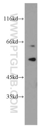 S6K2 Antibody in Western Blot (WB)