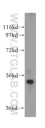 S6K2 Antibody in Western Blot (WB)