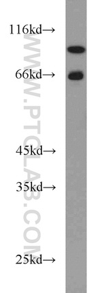 HJURP Antibody in Western Blot (WB)