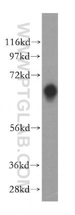 TSTA3 Antibody in Western Blot (WB)